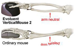 Evoluent VerticalMouse 2